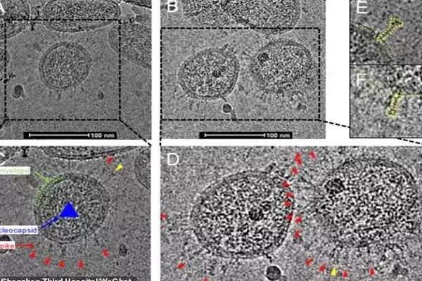Read more about the article वैज्ञानिकों को मिली बड़ी सफलता, कोरोना वायरस की पहली तस्वीर कैमरे में हुई कैद, देखें